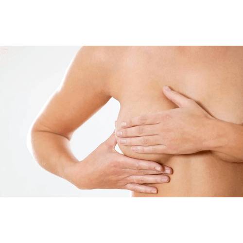 Breast Health Bombshell  - What every woman should know... by Nadine Artemis