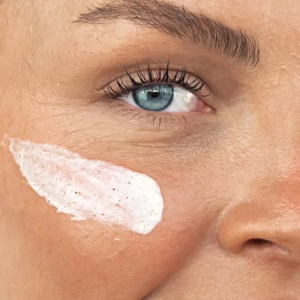 Close-up of a person's eye with a white patch on the skin